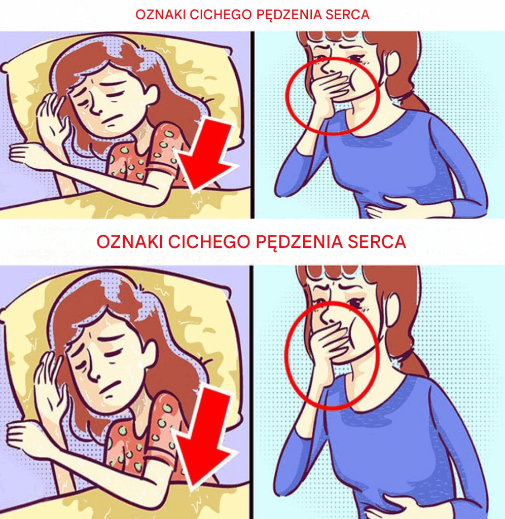 6_oznak_cichego_zawa_u_serca__kt_re_wci___s__ignorowane 6_oznak_cichego_zawa_u_serca__kt_re_wci___s__ignorowane