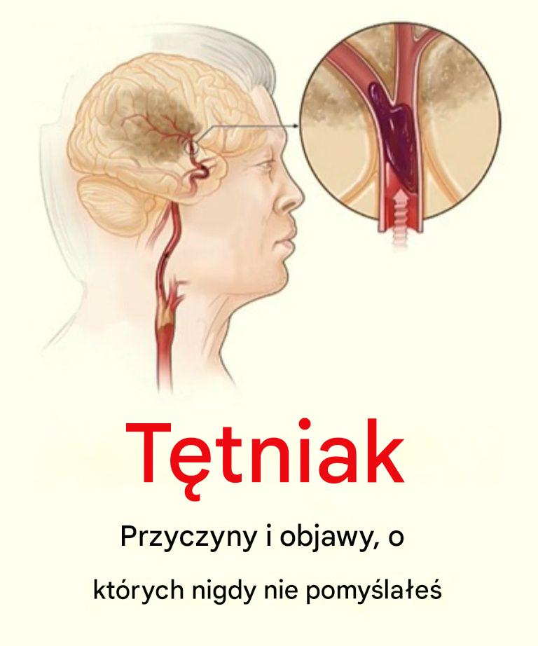 7_nawyk_w__kt_re_pomagaj__zmniejszy__ryzyko_wyst_pienia_t_tniaka 7_nawyk_w__kt_re_pomagaj__zmniejszy__ryzyko_wyst_pienia_t_tniaka