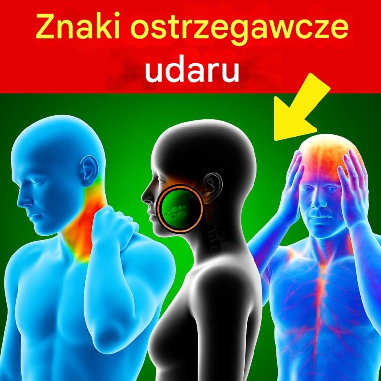 7_objaw_w_udaru_m_zgu___co_musisz_wiedzie__-2