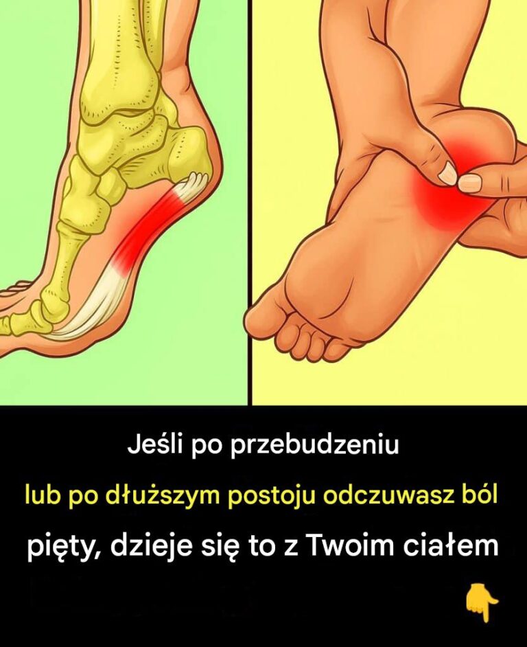 7_skutecznych__wicze___agodz_cych_b_l_pi_ty_i_lecz_cych_zapalenie_powi_zi_podeszwowej_w_spos_b_naturalny-1