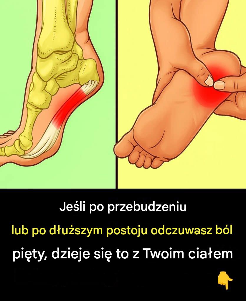 7_skutecznych__wicze___agodz_cych_b_l_pi_ty_i_lecz_cych_zapalenie_powi_zi_podeszwowej_w_spos_b_naturalny-1 7_skutecznych__wicze___agodz_cych_b_l_pi_ty_i_lecz_cych_zapalenie_powi_zi_podeszwowej_w_spos_b_naturalny-1
