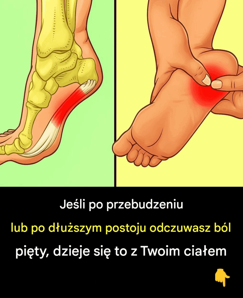 7_skutecznych__wicze___agodz_cych_b_l_pi_ty_i_lecz_cych_zapalenie_powi_zi_podeszwowej_w_spos_b_naturalny 7_skutecznych__wicze___agodz_cych_b_l_pi_ty_i_lecz_cych_zapalenie_powi_zi_podeszwowej_w_spos_b_naturalny