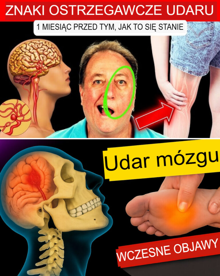 8_ostrzegawczych_objaw_w_udaru_i_9_wskaz_wek__jak_mu_zapobiega_