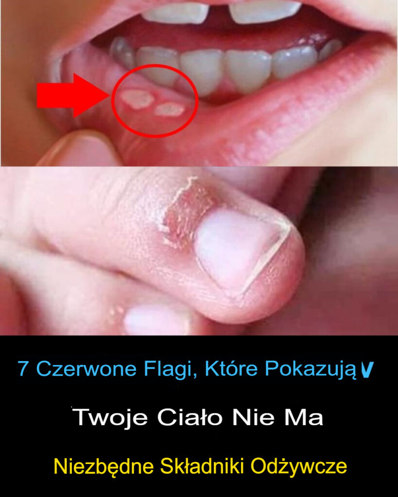 8_wczesnych_sygna__w_ostrzegawczych_niedoboru_sk_adnik_w_od_ywczych_wypisanych_na_ca_ym_ciele 8_wczesnych_sygna__w_ostrzegawczych_niedoboru_sk_adnik_w_od_ywczych_wypisanych_na_ca_ym_ciele