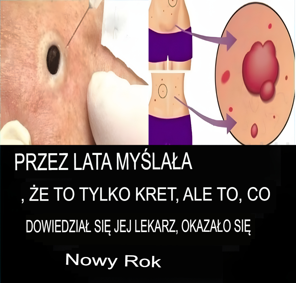 9_ostrzegawczych_sygna__w___e_w_Twoim_organizmie_rozwija_si__rak__kt_re_kobiety_cz_sto_ignoruj__-1 9_ostrzegawczych_sygna__w___e_w_Twoim_organizmie_rozwija_si__rak__kt_re_kobiety_cz_sto_ignoruj__-1