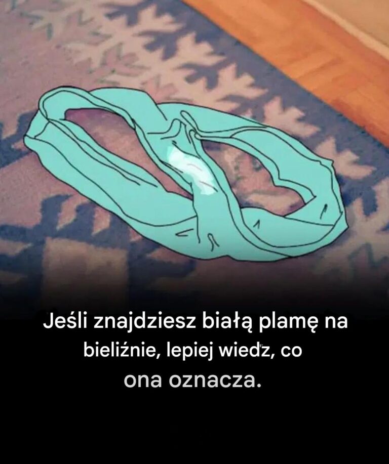 Ale_co_tak_naprawd__oznaczaj__te_plamy_