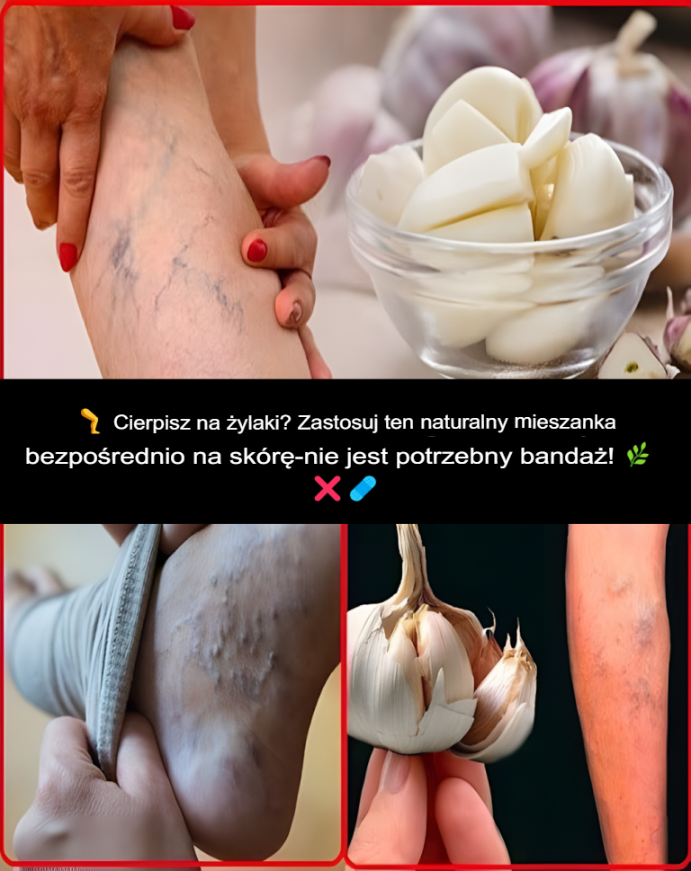B_l_n_g__reumatyzm___ylaki__artretyzm__b_le_g_owy__b_le_staw_w__Naturalna_medycyna_matki_ B_l_n_g__reumatyzm___ylaki__artretyzm__b_le_g_owy__b_le_staw_w__Naturalna_medycyna_matki_