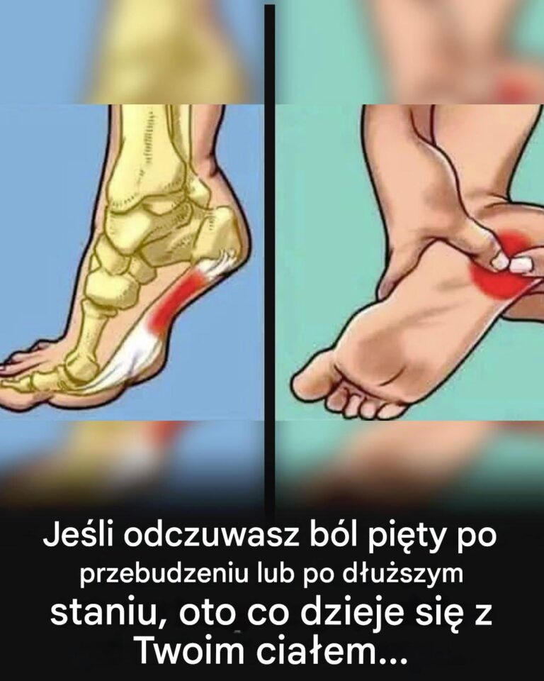 B_l_pi_ty__najcz_stsze_przyczyny_i_rola_zapalenia_rozci_gna_podeszwowego