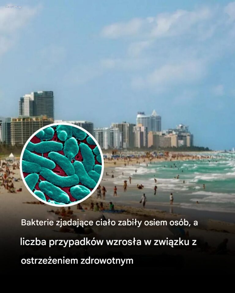 Bakterie_zjadaj_ce_cia_o_zabi_y_osiem_os_b__a_liczba_przypadk_w_wzros_a_w_zwi_zku_z_ostrze_eniem_zdrowotnym