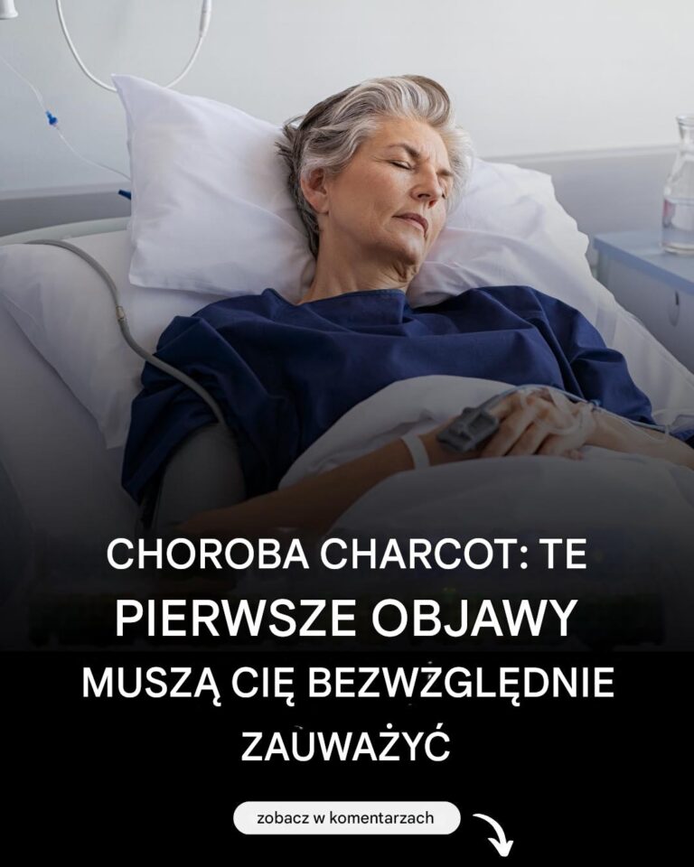 Choroba_Lou_Gehriga__oto_pierwsze_objawy_tej_choroby