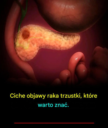 Ciche_objawy_raka_trzustki__kt_re_warto_zna_ Ciche_objawy_raka_trzustki__kt_re_warto_zna_