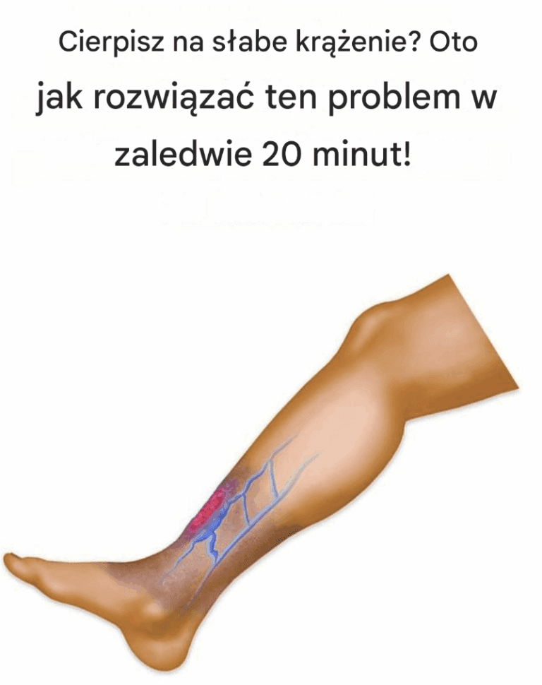Cierpisz_na_s_abe_kr__enie__Oto_jak_rozwi_za__ten_problem_w_zaledwie_20_minut_
