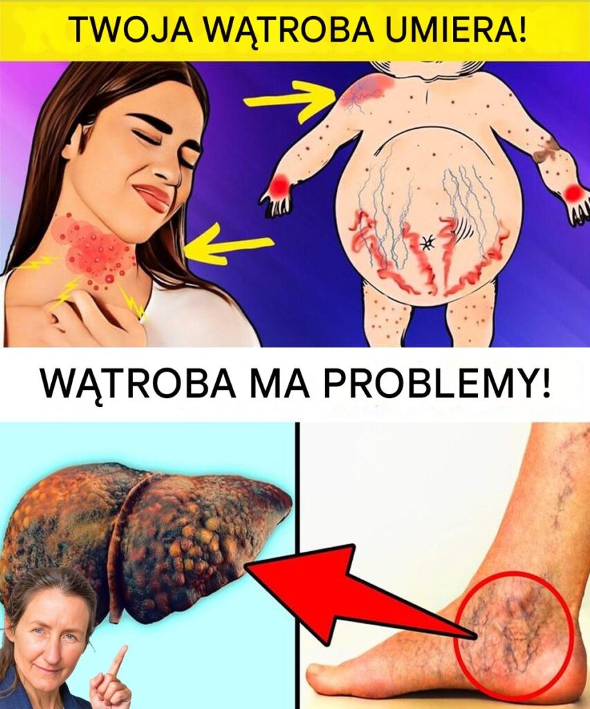 Co_Twoje_Stopy_Mog__Ci_Powiedzie__O_Twoim_Zdrowiu__Na_Co_Nale_y_Zwraca__Uwag___W_Tym_Problemy_Z_W_trob_ Co_Twoje_Stopy_Mog__Ci_Powiedzie__O_Twoim_Zdrowiu__Na_Co_Nale_y_Zwraca__Uwag___W_Tym_Problemy_Z_W_trob_