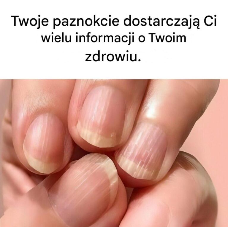 Co_Twoje_paznokcie_m_wi__o_Twoim_zdrowiu