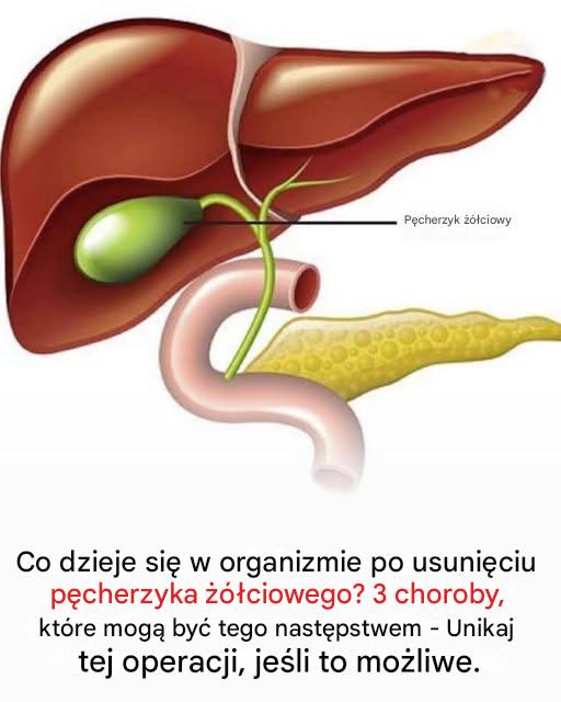 Co_dzieje_si__w_organizmie_po_usuni_ciu_p_cherzyka____ciowego__3_choroby__kt_re_mog__by__tego_konsekwencj_ Co_dzieje_si__w_organizmie_po_usuni_ciu_p_cherzyka____ciowego__3_choroby__kt_re_mog__by__tego_konsekwencj_