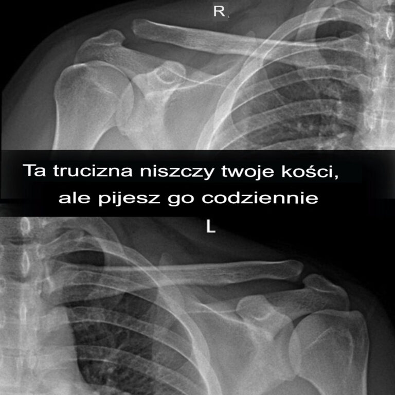 Co_si__dzieje__gdy_pijesz_nap_j_gazowany_