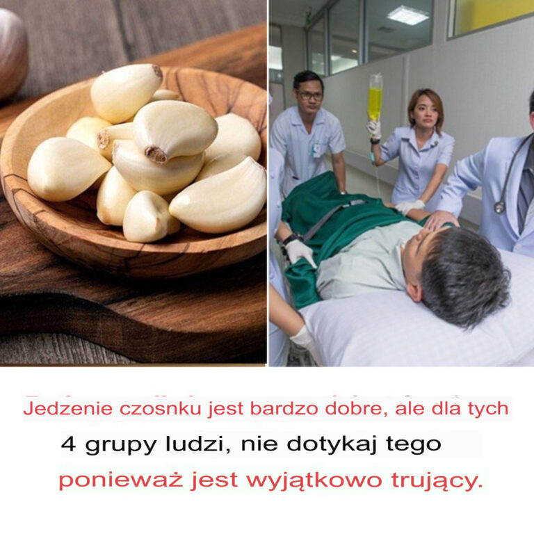 Czosnek_jest_zdrowy__ale_toksyczny_dla_tych_4_grup