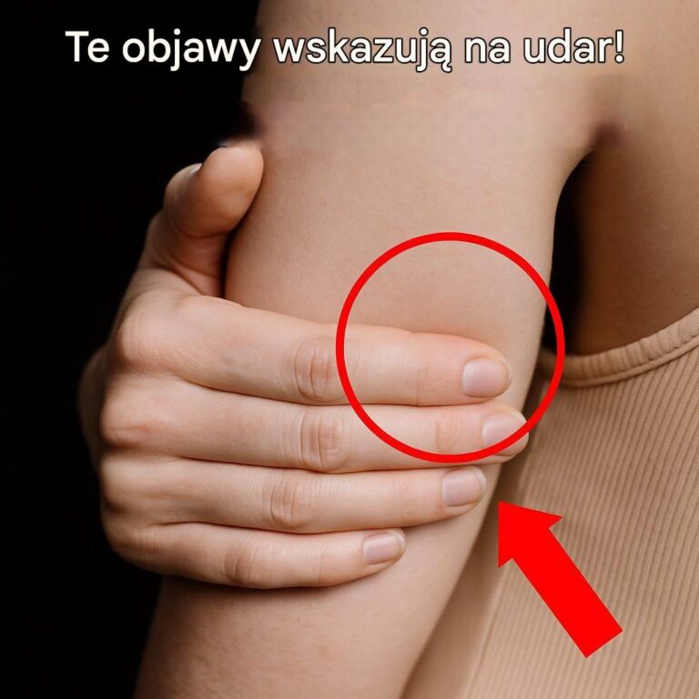 Czy_to_zm_czenie__czy_udar__Oto_sygna_y_ostrzegawcze__kt_rych_kobiety_nie_powinny_ignorowa_