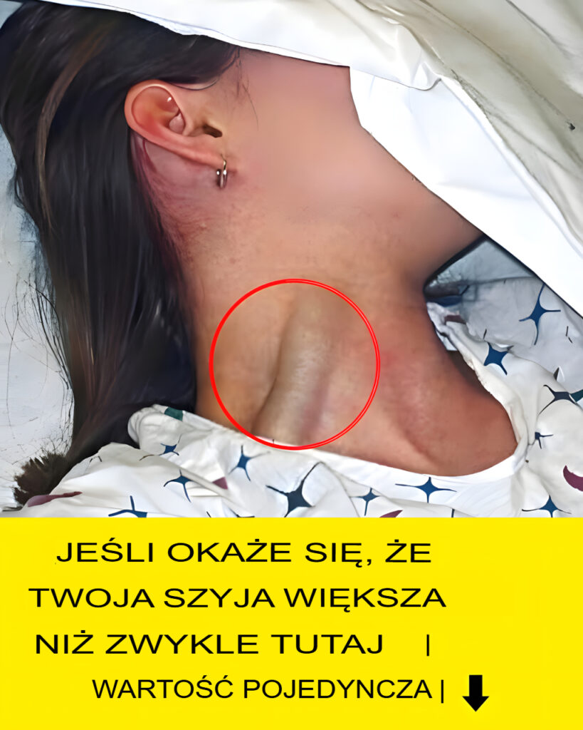 Czy_zauwa_y_e____e_Twoja_szyja_wydaje_si__grubsza_ni__normalnie__bez_przybierania_na_wadze_i_nieprawid_owej_postawy_ Czy_zauwa_y_e____e_Twoja_szyja_wydaje_si__grubsza_ni__normalnie__bez_przybierania_na_wadze_i_nieprawid_owej_postawy_