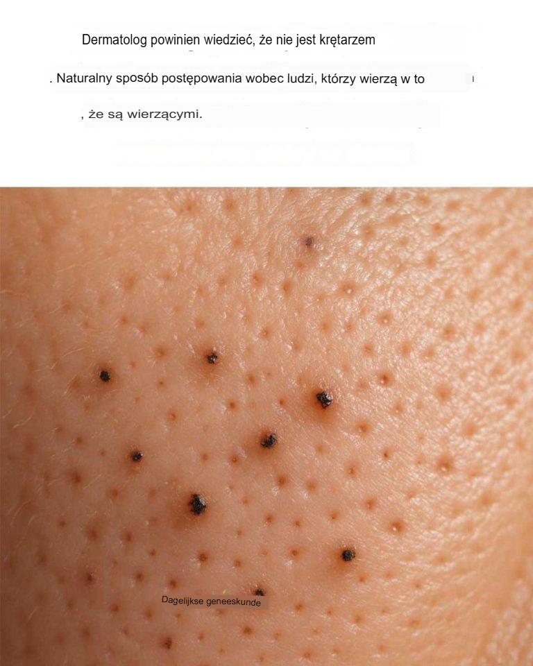 Dermatolodzy_ci_tego_nie_powiedz_ Dermatolodzy_ci_tego_nie_powiedz_