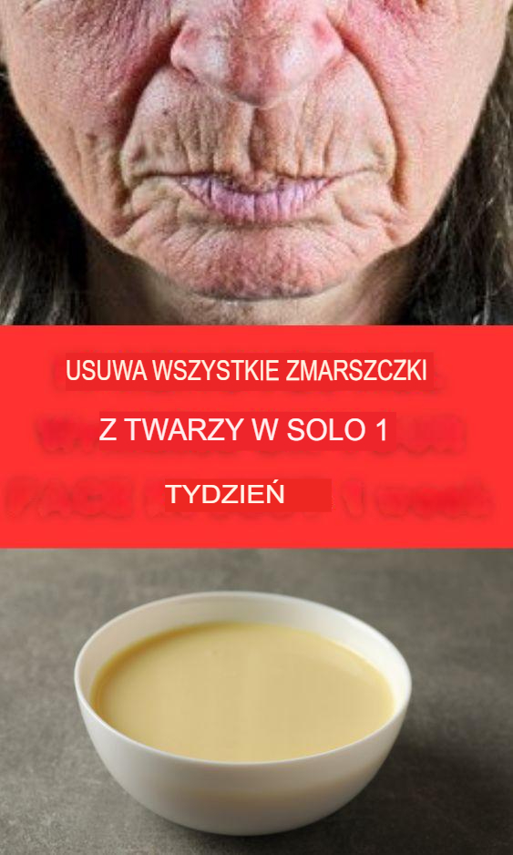 Dzi_ki_temu_kremowi_pozby_am_si__zmarszczek_na_twarzy Dzi_ki_temu_kremowi_pozby_am_si__zmarszczek_na_twarzy