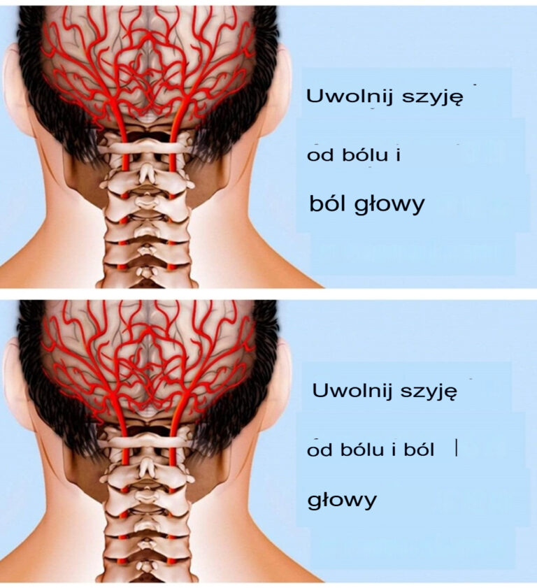 Fizjoterapeuta_pokazuje_metody__agodzenia_b_lu_szyi_i_plec_w
