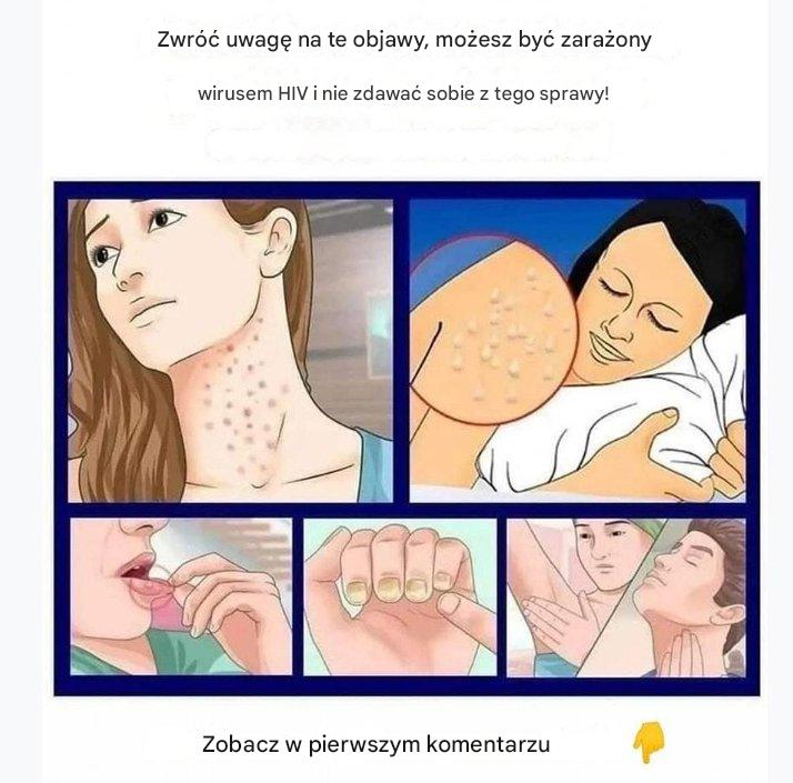 HIV__pierwsze_objawy__kt_rych_nie_mo_na_ignorowa__-1 HIV__pierwsze_objawy__kt_rych_nie_mo_na_ignorowa__-1