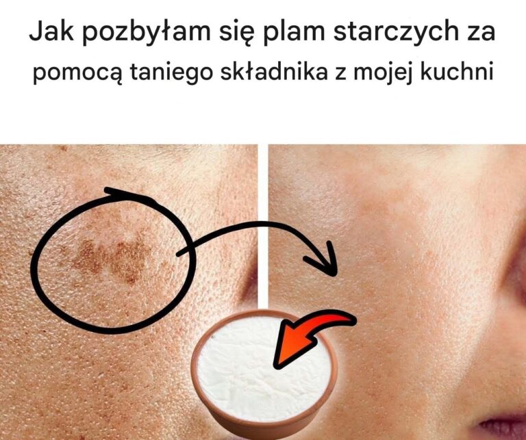 Jak_pozby_am_si__plam_starczych_za_pomoc__taniego_sk_adnika_z_mojej_kuchni-1