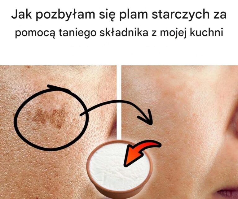 Jak_pozby_am_si__plam_starczych_za_pomoc__taniego_sk_adnika_z_mojej_kuchni