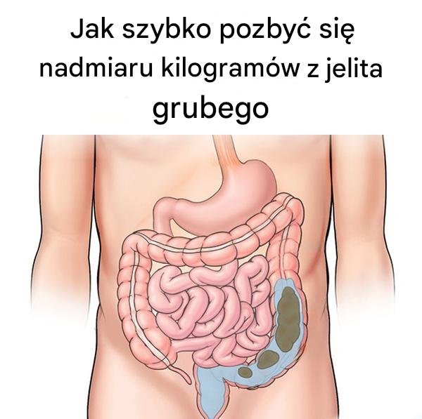 Jak_szybko_pozby__si__nadmiaru_kilogram_w_z_jelita_grubego-1 Jak_szybko_pozby__si__nadmiaru_kilogram_w_z_jelita_grubego-1