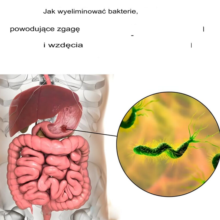 Jak_wyeliminowa__bakterie_powoduj_ce_zgag__i_wzd_cia