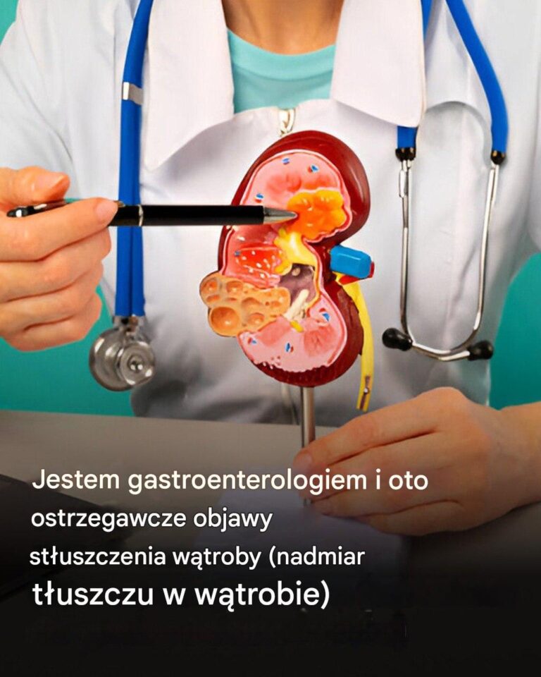 Jako_gastroenterolog_wyja_ni__Pa_stwu_pierwsze_objawy__kt_re_mog__wskazywa__na_st_uszczenie_w_troby__czyli_nadmiar_t_uszczu_w_w_trobie_