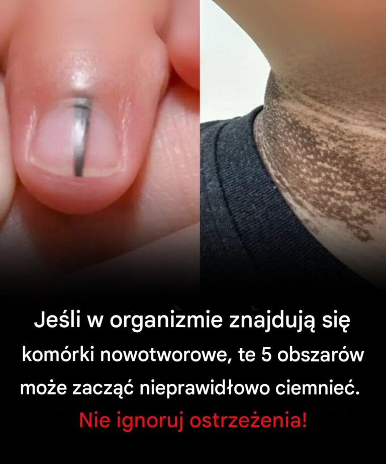 Je_li_w_organizmie_znajduj__si__kom_rki_nowotworowe__te_5_obszar_w_mo_e_zacz___nieprawid_owo_ciemnie_