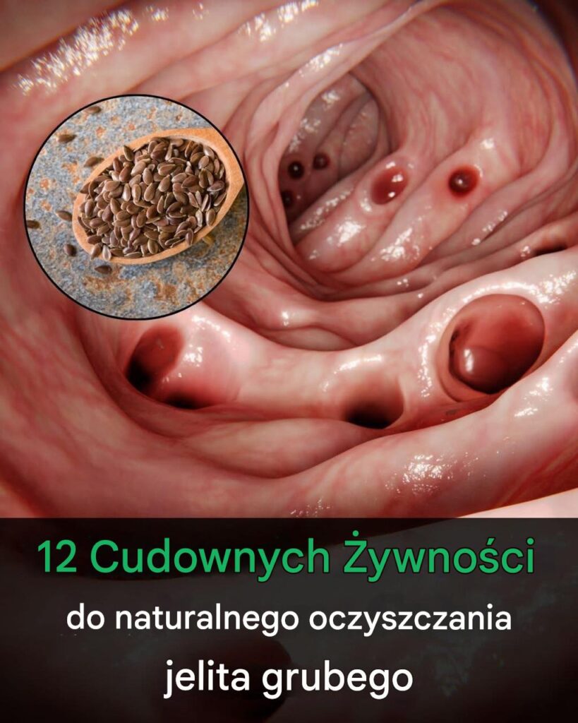 Jelita_w_formie__12_naturalnych_produkt_w__kt_re_Twoje_trawienie_pokocha-1 Jelita_w_formie__12_naturalnych_produkt_w__kt_re_Twoje_trawienie_pokocha-1
