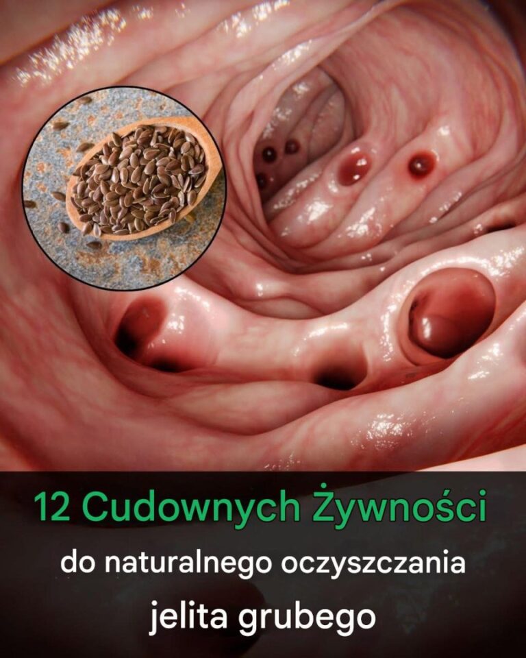 Jelita_w_formie__12_naturalnych_produkt_w__kt_re_Twoje_trawienie_pokocha