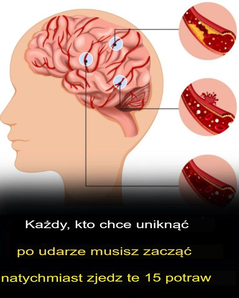 Ka_dy__kto_chce_unikn___udaru__powinien_natychmiast_zacz___je___te_15_produkt_w-1 Ka_dy__kto_chce_unikn___udaru__powinien_natychmiast_zacz___je___te_15_produkt_w-1