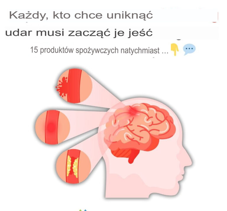 Ka_dy__kto_chce_unikn___udaru__powinien_natychmiast_zacz___je___te_15_produkt_w