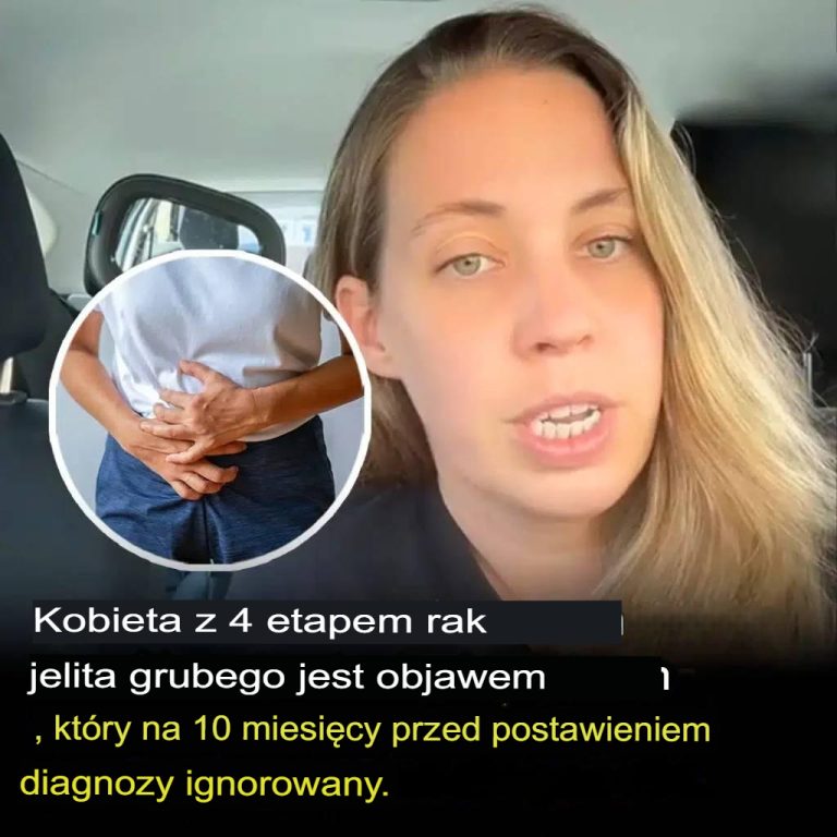 Kobieta_z_rakiem_jelita_grubego_w_stadium_4_dzieli_si__objawami__kt_re_ignorowa_a_10_miesi_cy_przed_diagnoz_-1 Kobieta_z_rakiem_jelita_grubego_w_stadium_4_dzieli_si__objawami__kt_re_ignorowa_a_10_miesi_cy_przed_diagnoz_-1
