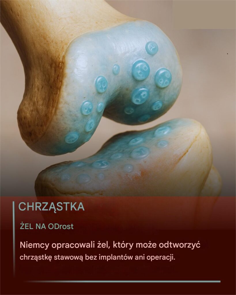 Koniec_z_b_lem_staw_w___el_opracowany_w_Niemczech_mo_e_by__prze_omem_w_regeneracji_chrz_stki Koniec_z_b_lem_staw_w___el_opracowany_w_Niemczech_mo_e_by__prze_omem_w_regeneracji_chrz_stki