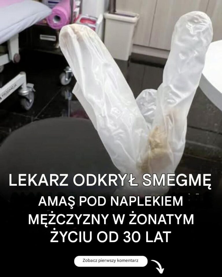Lekarz_odkry__30_letnie_nagromadzenie_smegmy_pod_napletkiem__onatego_m__czyzny__kt_ry_cierpia__z_powodu_potwornego_b_lu