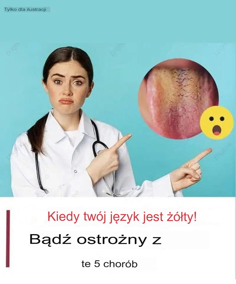 Mengsel_van_Vaseline_en_caf___dlaczego_nie_wiedzia_em_o_tym_wcze_niej___ Mengsel_van_Vaseline_en_caf___dlaczego_nie_wiedzia_em_o_tym_wcze_niej___