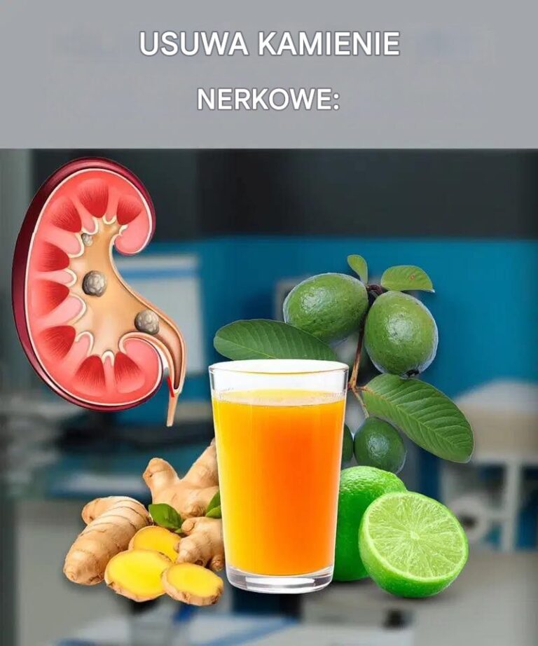 Nap_j__kt_ry_w_mgnieniu_oka_usuwa_kamienie_nerkowe