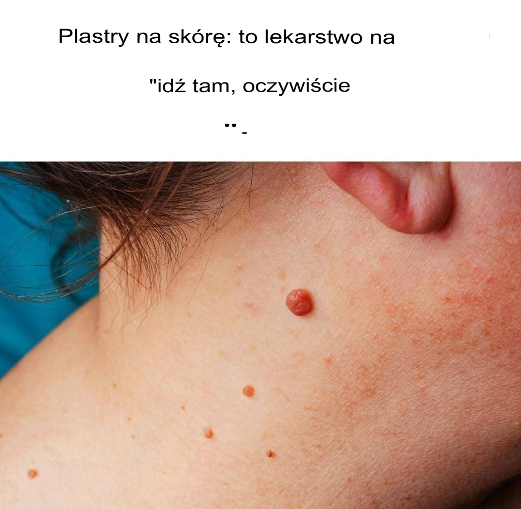 Naro_la_sk_rne__jak_pozby__si__ich_naturalnie Naro_la_sk_rne__jak_pozby__si__ich_naturalnie