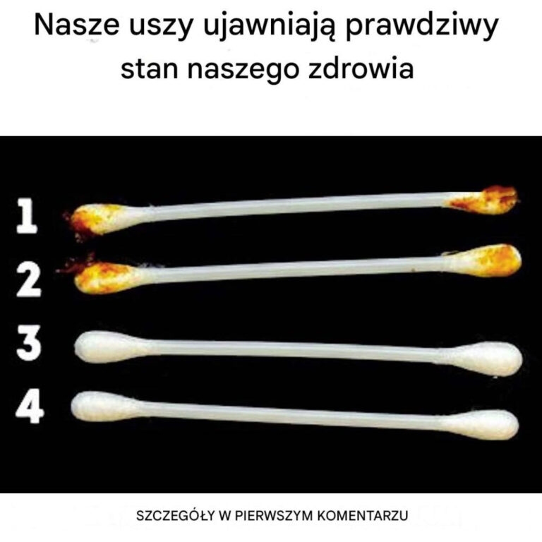 Nasze_uszy_ujawniaj__prawdziwy_stan_naszego_zdrowia-1