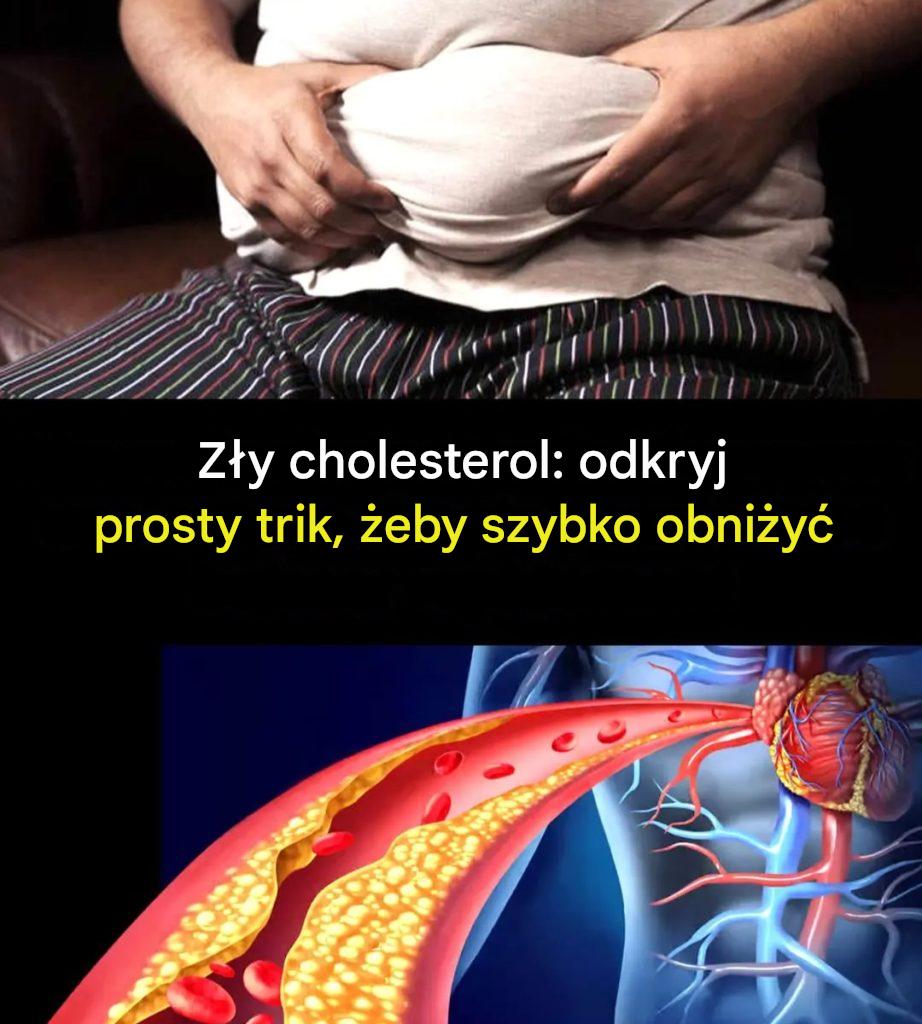 Naturalne_sposoby_na_obni_enie_szkodliwego_poziomu_cholesterolu Naturalne_sposoby_na_obni_enie_szkodliwego_poziomu_cholesterolu