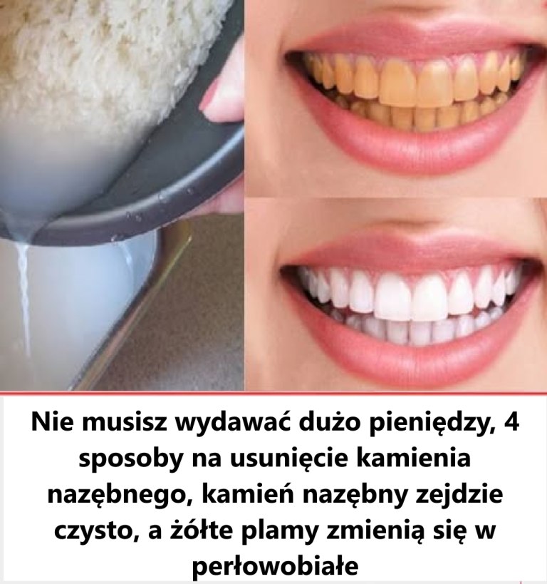 Nie_marnuj_wi_cej_pieni_dzy_na_dentyst__ Nie_marnuj_wi_cej_pieni_dzy_na_dentyst__