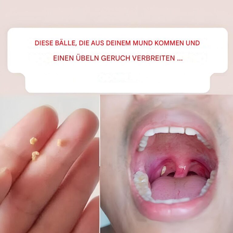 Nie_wie_y_oddech__domowy_spos_b_na__wie_y_oddech-2 Nie_wie_y_oddech__domowy_spos_b_na__wie_y_oddech-2