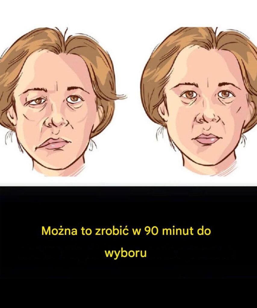 Objawy_udaru_mog__pojawi__si__nawet_90_dni_wcze_niej Objawy_udaru_mog__pojawi__si__nawet_90_dni_wcze_niej