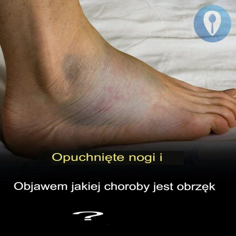 Obrz_k_n_g_i_obrz_k__jakie_mog__by__przyczyny_-1