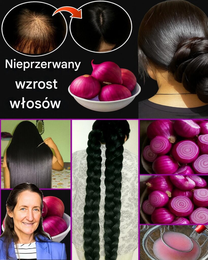 Olejek_cebulowy_do_w_os_w__Tw_j_domowy_sekret_mocniejszych_w_os_w Olejek_cebulowy_do_w_os_w__Tw_j_domowy_sekret_mocniejszych_w_os_w
